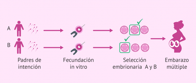 Imagen: Transferencia embrionaria de cada padre de intención