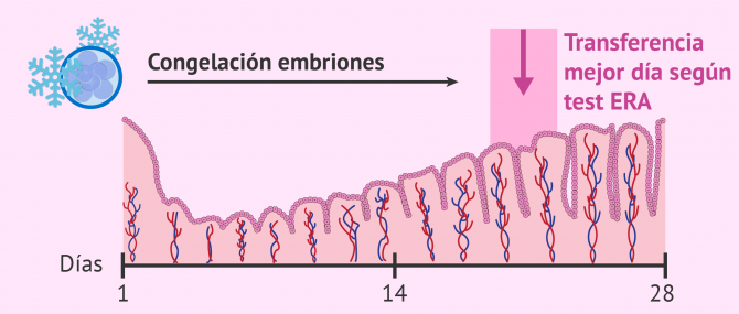 Soluciones al fallo de implantación