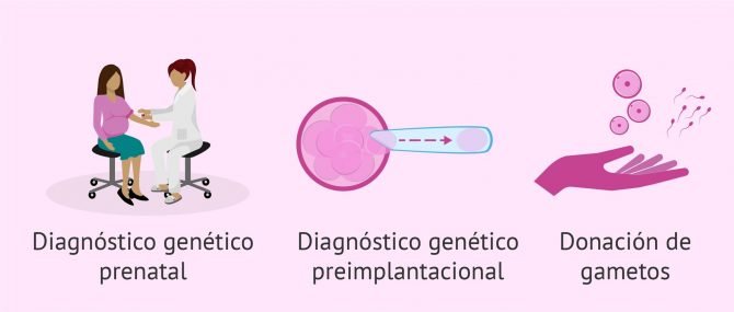 Aborto por alteraciones genéticas