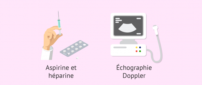 Imagen: Comment se déroule la grossesse avec une thrombophilie?