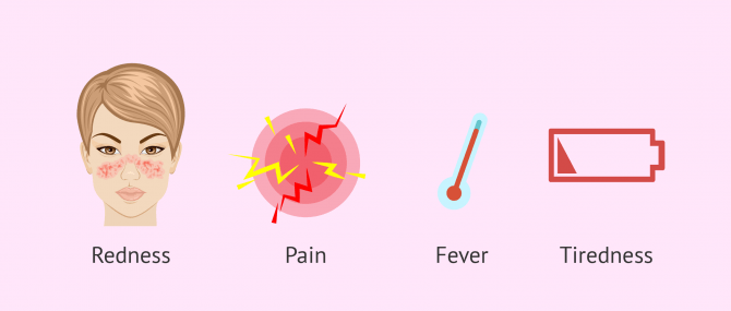 Imagen: autoimmune disease symptoms