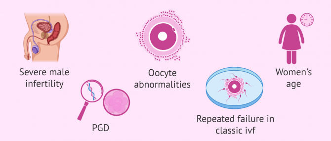 Imagen: Cases in which ICSI is necessary