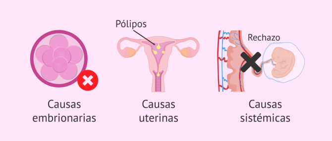 Imagen: ¿Por qué se producen los fallos de implantación embrionaria?