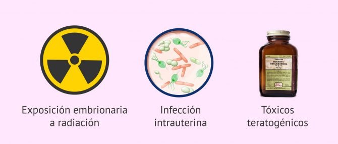 Imagen: Posibles causas de malformaciones uterinas
