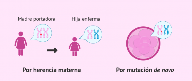 Imagen: Causas del síndrome de Morris