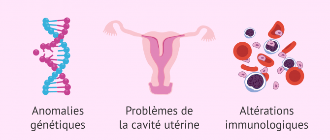 Causes de fausses-couches à répétition