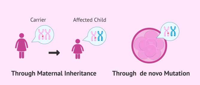 Imagen: causes of morris syndrome