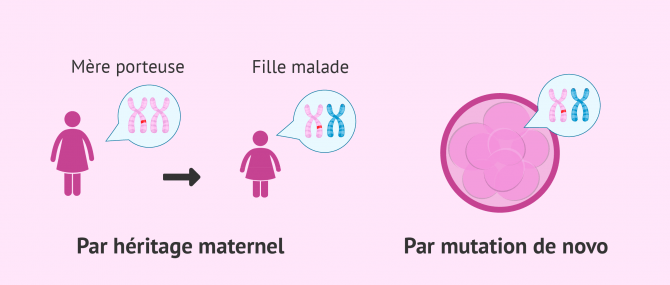 Imagen: Explication syndrome de Morris