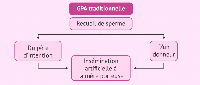 Combinaisons possibles en GPA traditionnelle