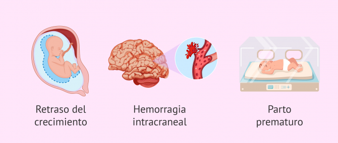 Complicaciones en el embarazo en mujeres con cardiopatías