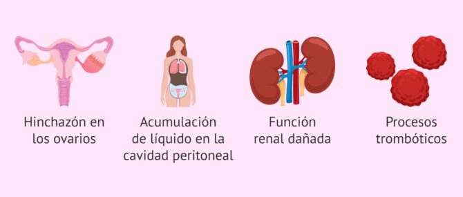 Imagen: Consecuencias del síndrome de hiperestimulación ovárica