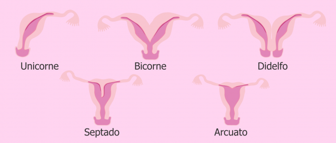 Imagen: Desarrollo anómalo del aparato reproductor