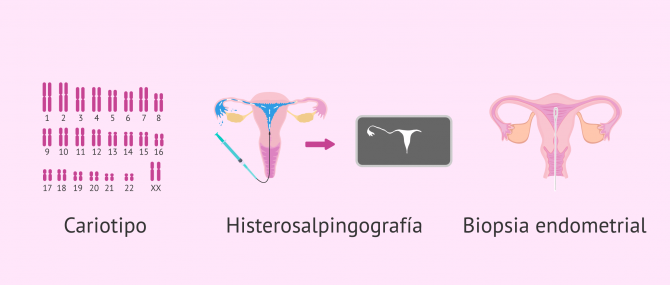 Imagen: Pruebas diagnósticas para casos de fallos de implantación