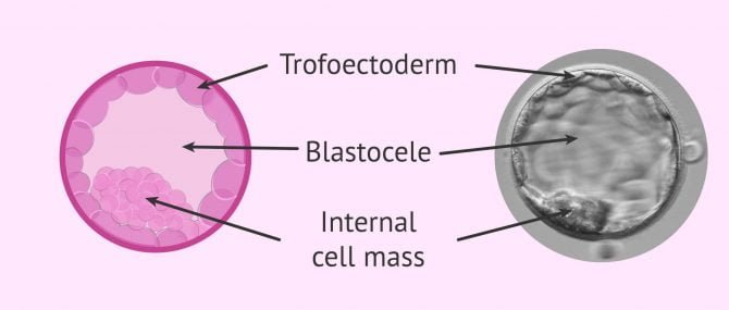 Imagen: Blastocyst stage