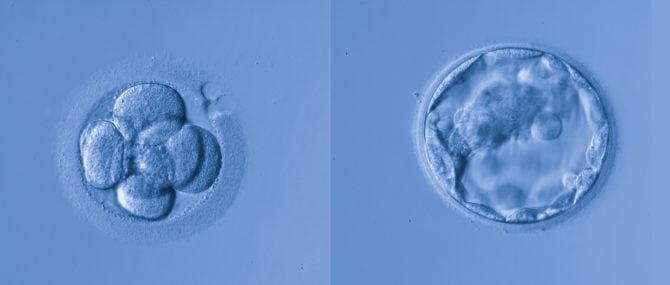 Imagen: Embryos for transfer