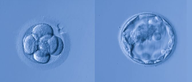 Imagen: Embryos für Transfer