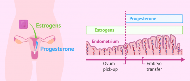 Imagen: Endometrial preparation for embryo transfer