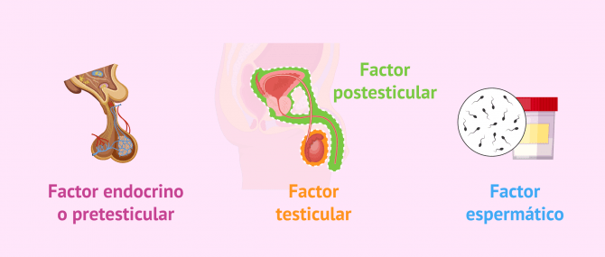 Imagen: Factores que provocan esterilidad masculina