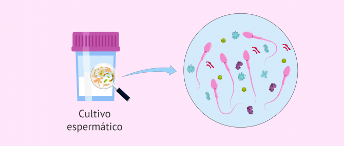 Imagen: Espermocultivo para comprobar si hay infección seminal