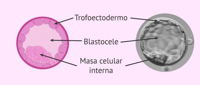 Imagen: Estadío de blastocisto