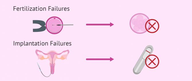 Imagen: Failed IVF or Implantation