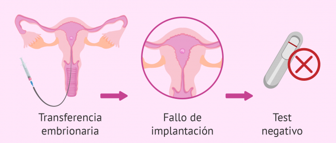 Fallos repetidos de implantación después de FIV