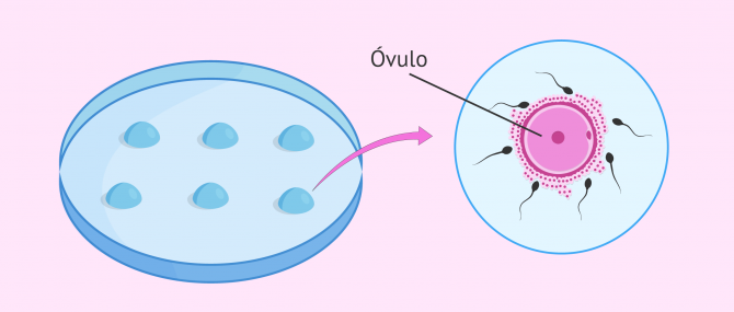 Imagen: Óvulo fecundado