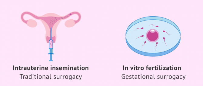 Fertility treatments used in surrogacy