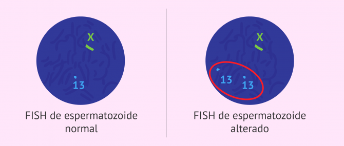 Imagen: Hibridación in situ o FISH de espermatozoides