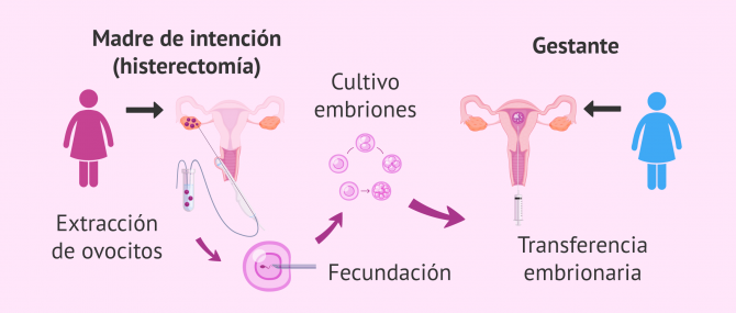 Imagen: fecundación in vitro con óvulos propios