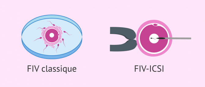 Imagen: FIV_ICSI