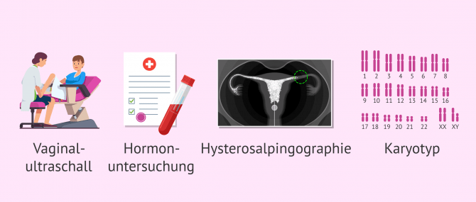 Imagen: Tests zur Untersuchung weiblicher Fruchtbarkeit