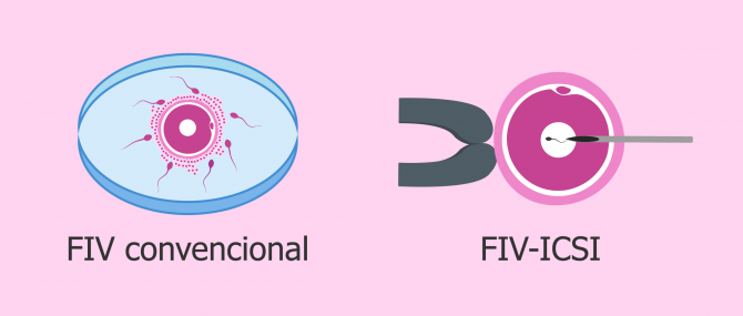 Unión óvulo y espermatozoide