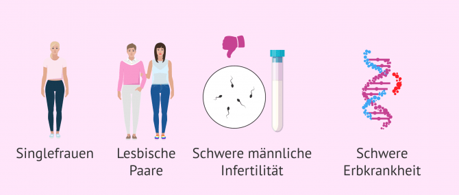 Imagen: Eizellen- und Samenspenden