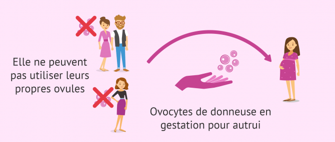 GPA et don d'ovocytes pour des raisons médicales