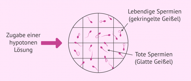 Imagen: Hyposmotischer Test zur Messung der Integrität der Spermienmembran