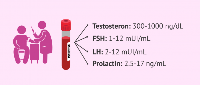 Imagen: Männliche Hormone untersuchen