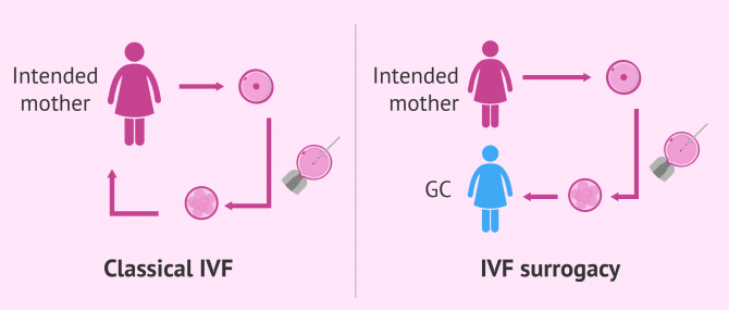 How does IVF surrogacy work?