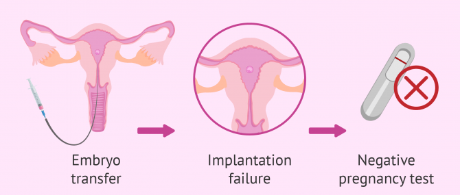 Imagen: Implantation failure
