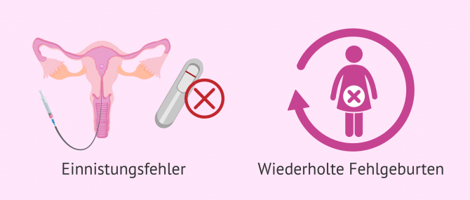 Imagen: Implantationsfehler und wiederholte Fehlgeburten