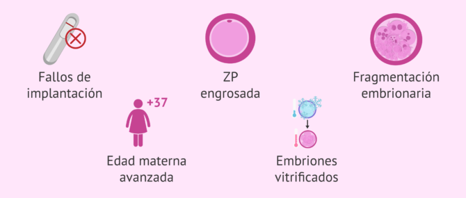 Imagen: Situaciones en las que se aconseja el hatching asistido