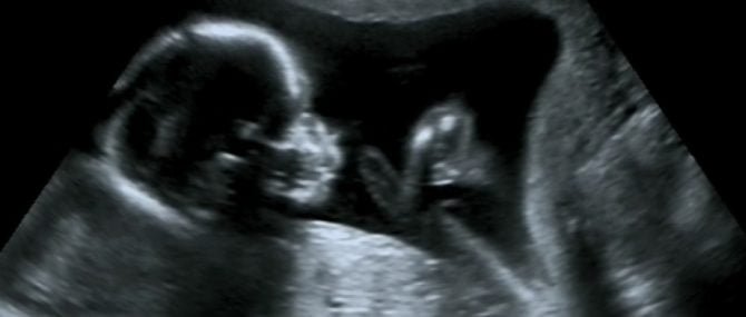 Information périodique sur la grossesse