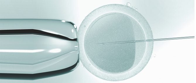 Imagen: IVF or ICSI