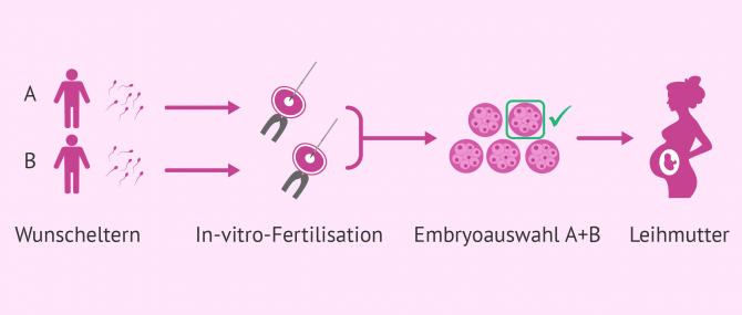 Imagen: Leihmutterschaft für schwule Paare