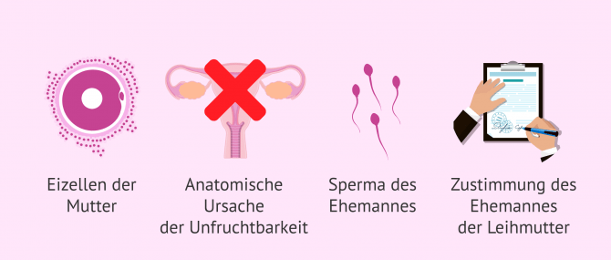 Imagen: Leihmutterschaft in Zlin