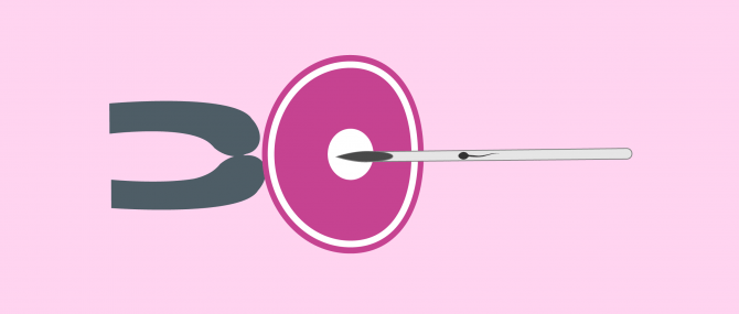 Imagen: Microinjection of Sperm into Oocyte