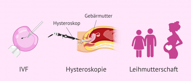 Imagen: Schwangerschaftsmöglichkeiten mit Gebärmutterfehlbildungen