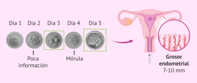 Imagen: Mejor momento para hacer la transferencia embrionaria