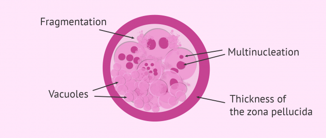 Imagen: morphological criteria