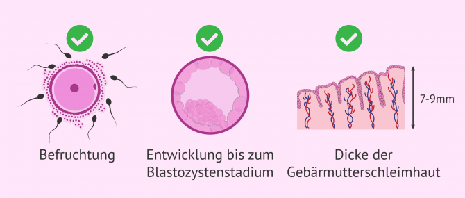 Imagen: Nochmal schwanger werden nach biochemischer Schwangerschaft